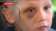 ‘He wasn’t moving’: Parents’ outrage after son, 5, brutally attacked with golf club