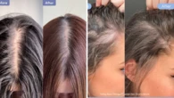 Clinically proven hair loss serum with ‘game-changing’ results finally goes on sale