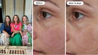 Trinny London drops revolutionary vitamin C serum you can use every day for glowing skin: ‘Vitamin C on steroids’