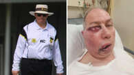 Senior cricket umpire speaks of brutal injury that left him unrecognisable