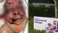 Family’s horror as dementia patient brutally attacked by another resident