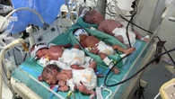 Desperate Gaza doctors cram several babies into one ICU cot