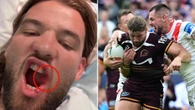 Origin selection thrown into disarray after gruesome mouth injury