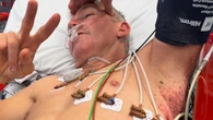 Aussie world champion in hospital with serious internal injuries