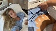 Aussie model’s health scare after finding cancerous tumour