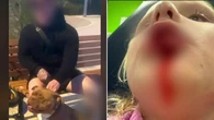 Police hunt dog owner after young girl attacked by pitbull