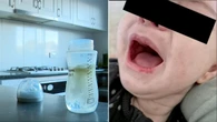 Aussie-based baby formula at centre of unsettling ‘malnutrition’ fears
