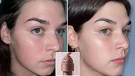 Cosmetic doctor-approved serum for dry skin this winter: ‘This is by far my favourite’