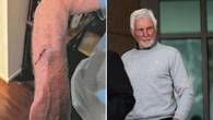 Shocking photos reveal AFL great’s injuries during alleged home invasion