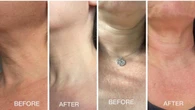 The $40 best-selling neck serum shoppers love: ‘One is selling every 10 minutes’