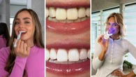 ‘Unreal savings’ up to 60 per cent off a whiter smile with SmilePro