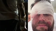 Grim details emerge after man allegedly slashed in face