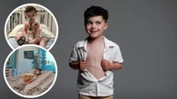 Courageous story of a Perth boy who lives with half a heart