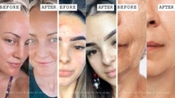 ‘Life-changing’ anti-ageing retinol kit drops to $132 for first 100 shoppers
