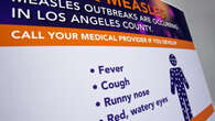 New measles alerts hit Western Sydney and Gold Coast on the same day