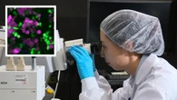 Major cancer breakthrough as immune cells captured devouring live melanoma