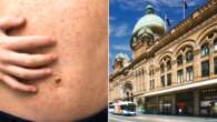 Measles scare hits Sydney after infected person visits popular cafes and malls