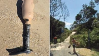 ‘Anyone missing a leg’: Cops probe crazy find on popular surf beach
