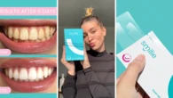 ‘Game-changing’ teeth whitening kit dentists recommend goes on sale