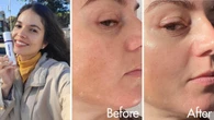 This beauty product is ‘guaranteed’ to reduce wrinkles and blemishes in 12 weeks
