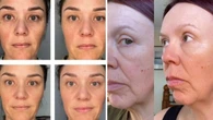 Meet the eye serum that can ‘reduce wrinkles by 194 per cent’