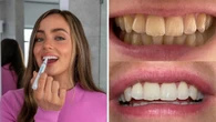 The 5K five-star review whitening kit just landed at Chemist Warehouse with 50 per cent off