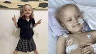 How AI, unicorns and family’s love helped Mackenzie’s fight against cancer