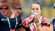 Tiny detail saves premiership hero in ‘traumatic’ injury