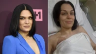 Jessie J shares emotional health update following breast cancer surgery