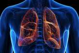 Lung-targeted CRISPR therapy offers hope for cystic fibrosis