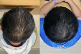 Serum based on plant extracts boosts hair growth in weeks
