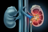 Magnetic gel could remove kidney stones more effectively