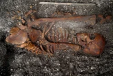 Syphilis-like bacteria found in 2000-year-old human remains in Brazil