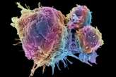 Why viewing cancer as an ecosystem could lead to better treatments