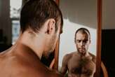 We may have found why people experience body dysmorphic disorder