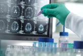 Contaminated hormone injections may have given five people Alzheimer's