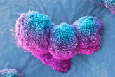 Pancreatic cancer halted by virus injection in three patients