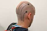 Temporary scalp tattoo can be used to record brain activity