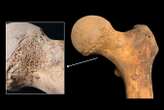 Traces of cannabis found in pre-modern human bones for the first time