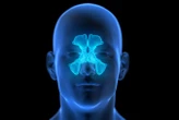 Go-to therapy for chronic sinus condition doesn't work that well