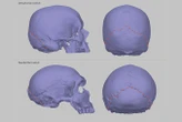A Neanderthal-shaped skull may explain why some people get headaches