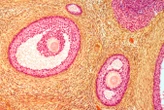 Our fertility window could be extended by making ovaries softer