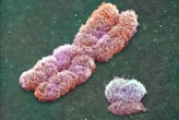 Vanishing Y chromosomes seem to be driving heart disease in men