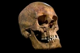 King Richard III's oral microbiome hints he had severe gum disease