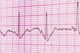 Quantum diamond sensor measured heart signals from a living rat