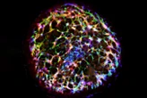 Blood vessel organoids quickly minimise damage to injured tissue