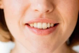 Cavities could be prevented by a gel that restores tooth enamel
