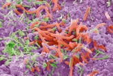 Your oral microbiome could affect your weight, liver and diabetes risk