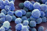 We are unlocking how frozen microbes stay alive for 100,000 years