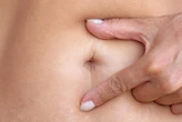 We now know why a belly button becomes an 'innie'